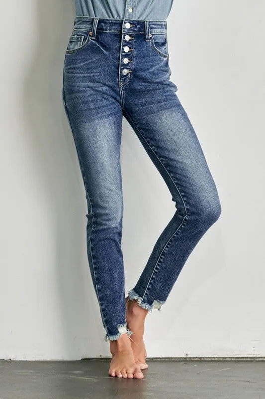 Eliana High Rise Exposed Button Skinny Jeans