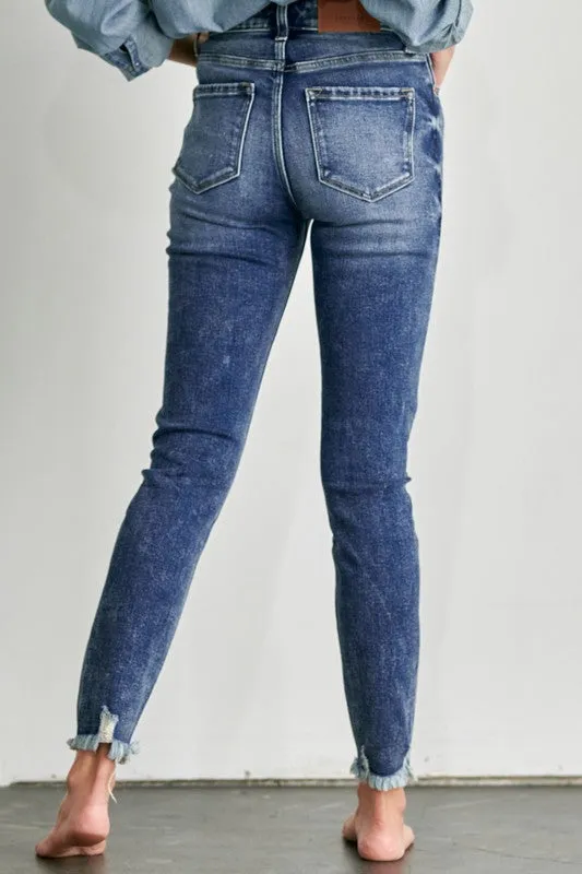 Eliana High Rise Exposed Button Skinny Jeans