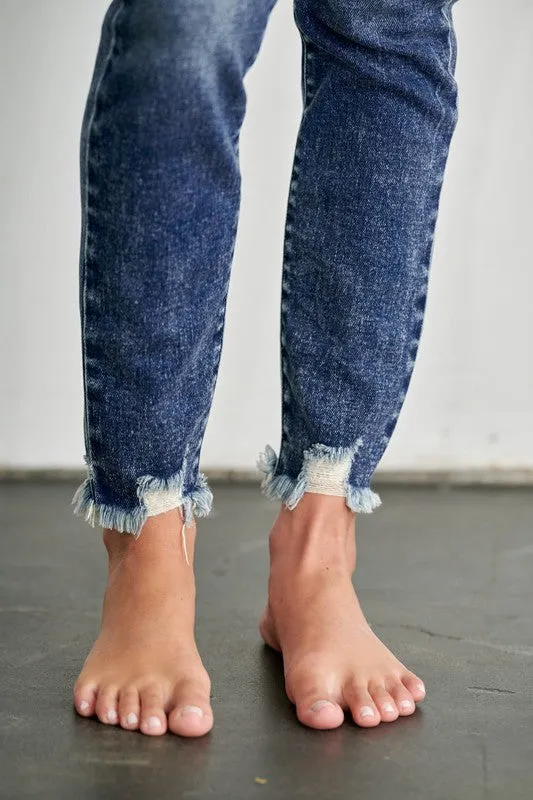 Eliana High Rise Exposed Button Skinny Jeans